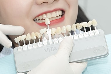 Cosmetic Dentistry Procedure
