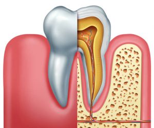 Tủy răng là gì?