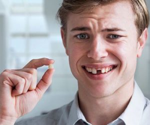 Phục hồi răng mất