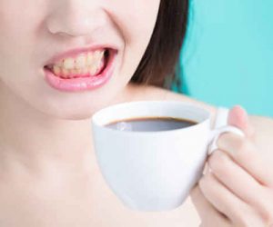 Chăm sóc răng sau tẩy trắng