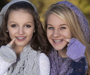 Thời gian niềng răng thay đổi giữa các bệnh nhân