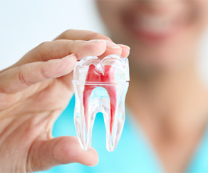 Tại sao cần phải chữa tủy răng